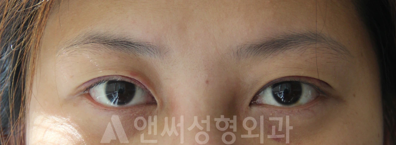 Answer Plastic Surgery case 680: After
