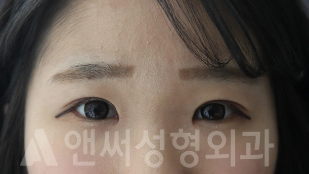 Answer Plastic Surgery case 679: After