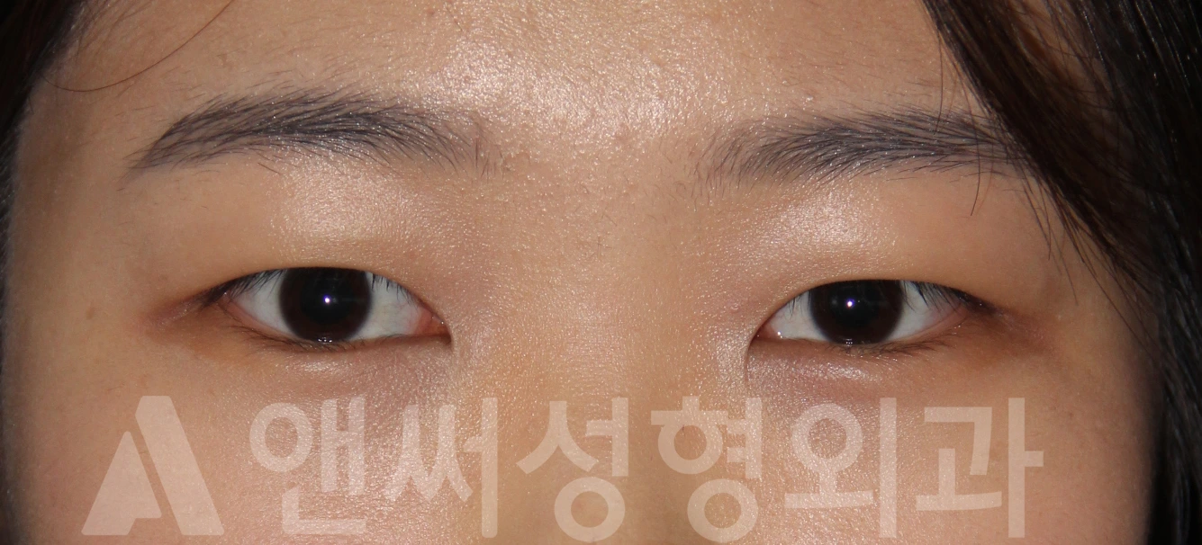 Answer Plastic Surgery case 678: Before