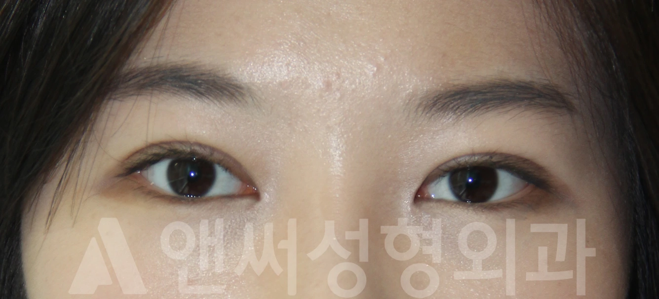 Answer Plastic Surgery case 678: After