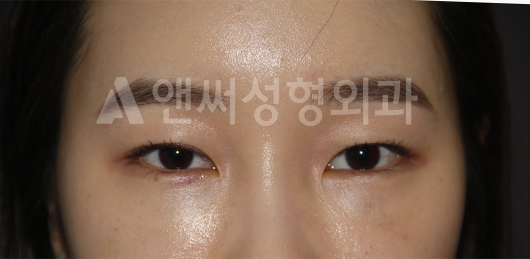Answer Plastic Surgery case 677: After