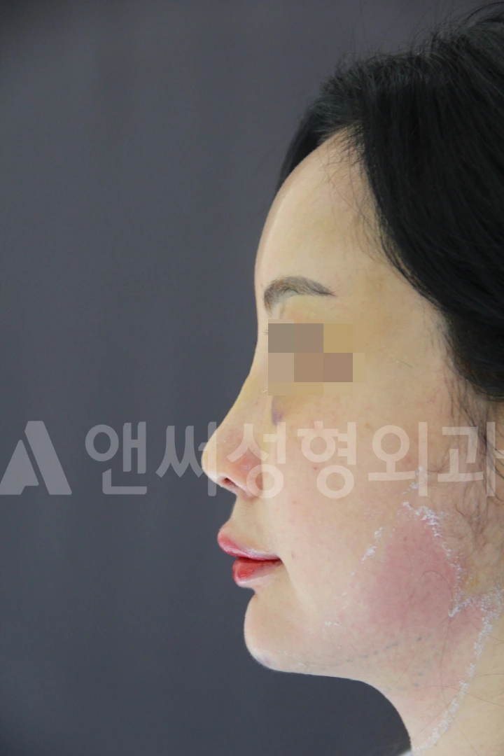 Answer Plastic Surgery case 676: After