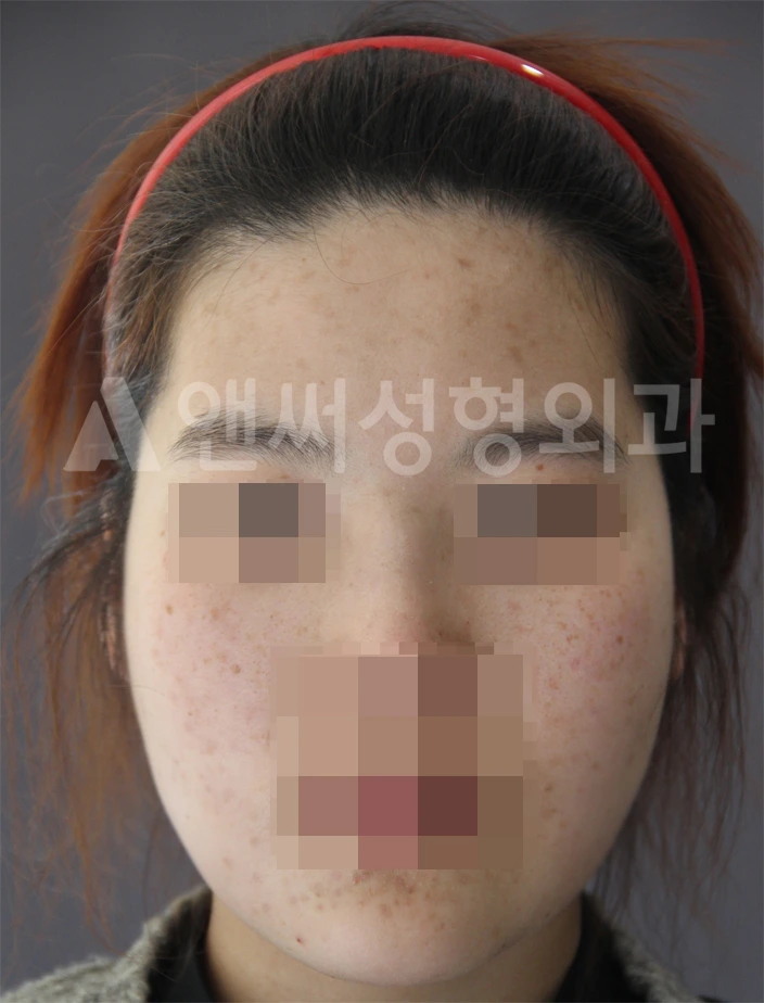 Answer Plastic Surgery case 675: After