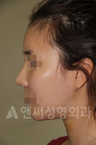 Answer Plastic Surgery case 674: After