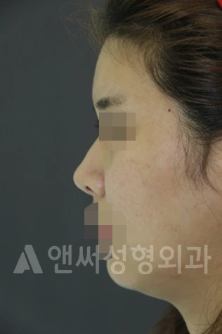 Answer Plastic Surgery case 673: Before