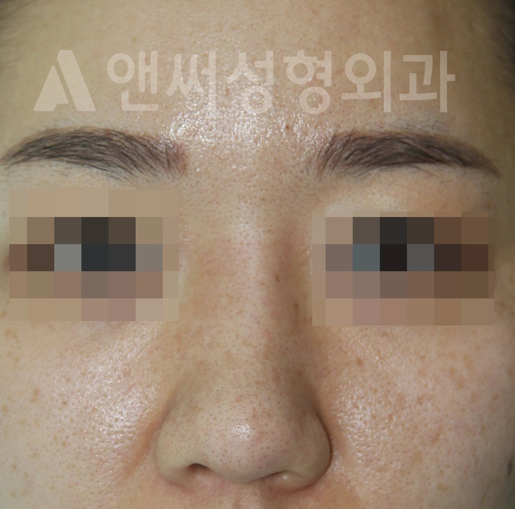 Answer Plastic Surgery case 670: Before