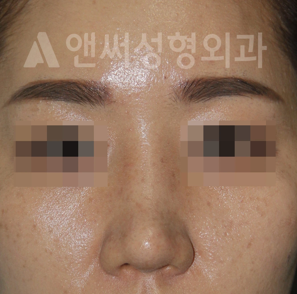 Answer Plastic Surgery case 670: After