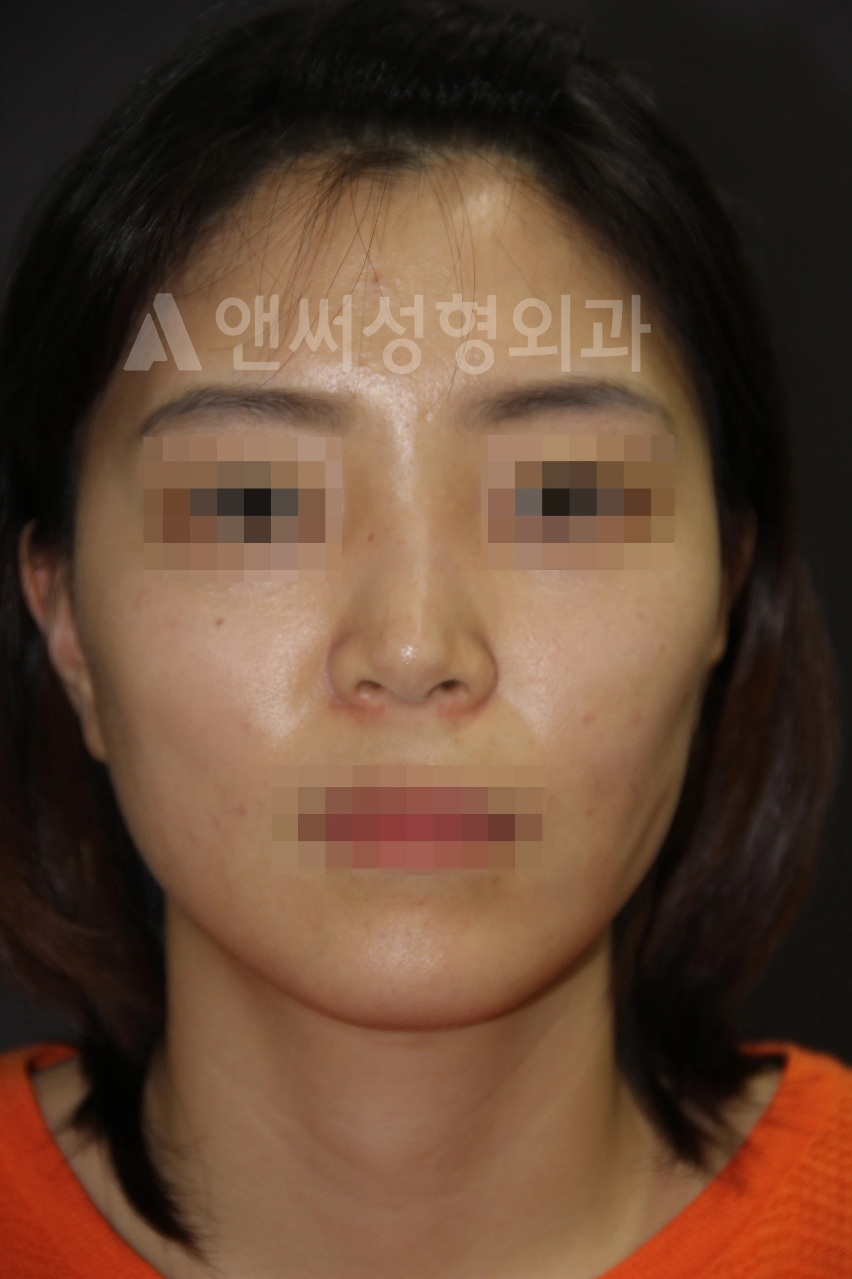 Answer Plastic Surgery case 669: After