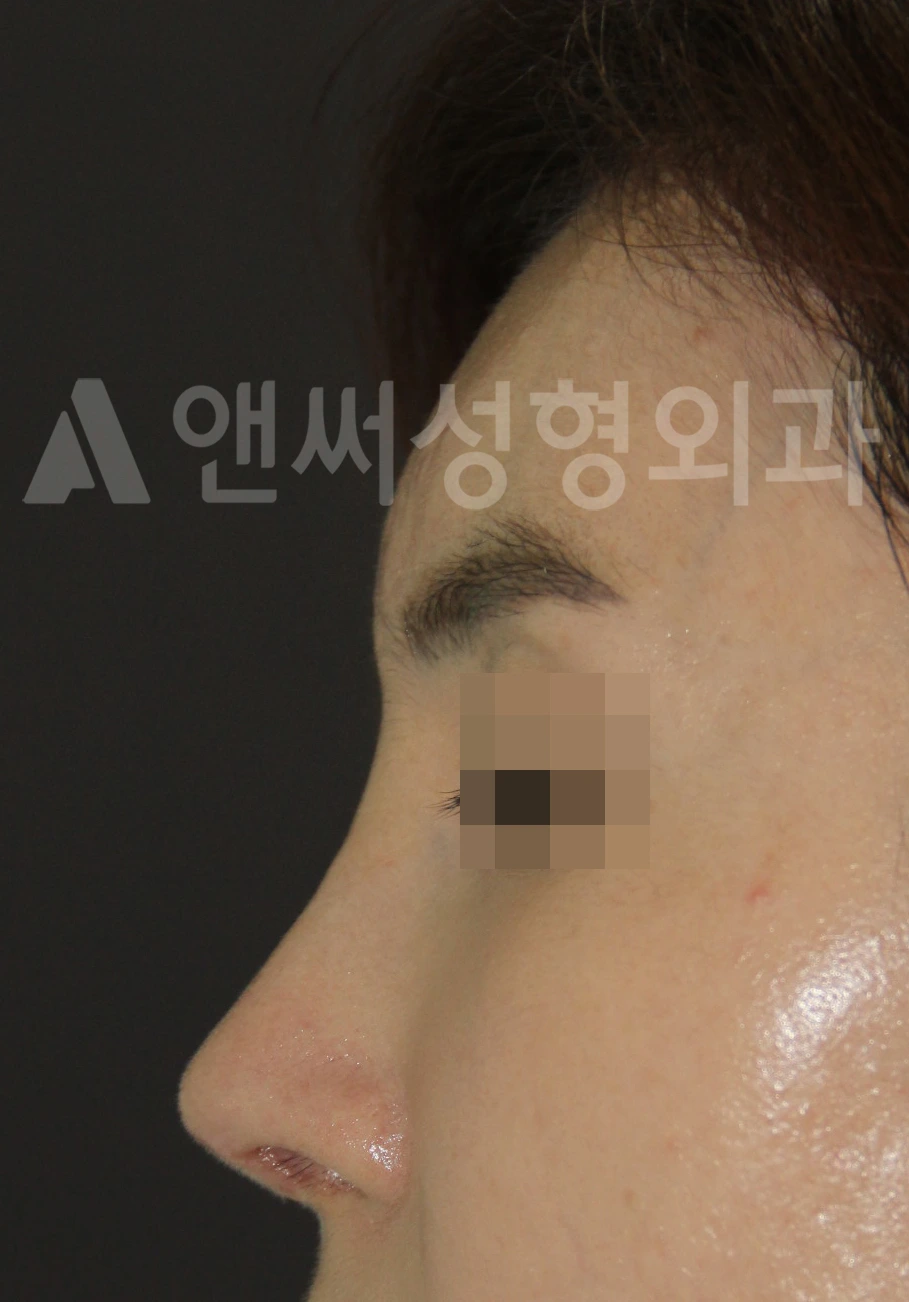 Answer Plastic Surgery case 668: After