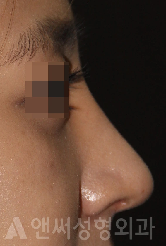 Answer Plastic Surgery case 667: After