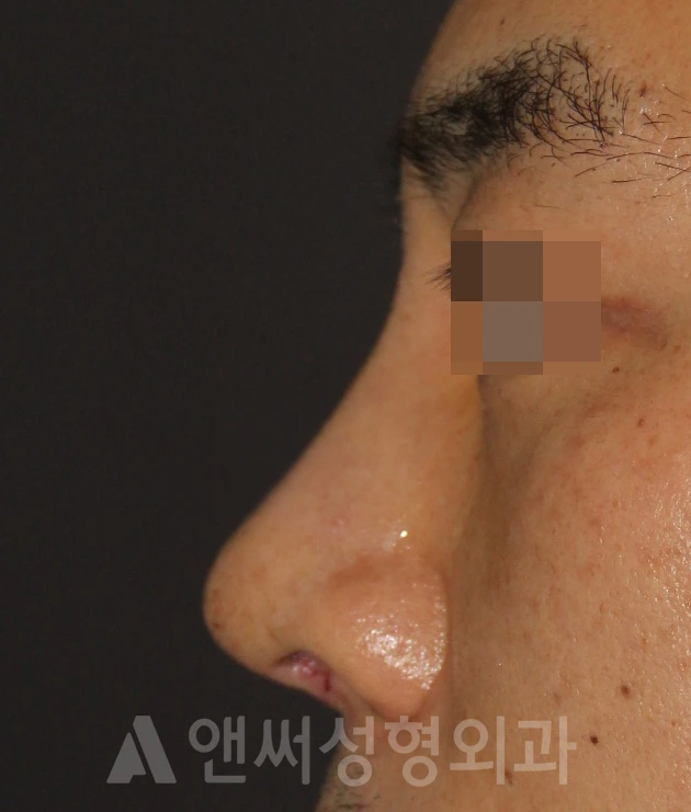 Answer Plastic Surgery case 666: After