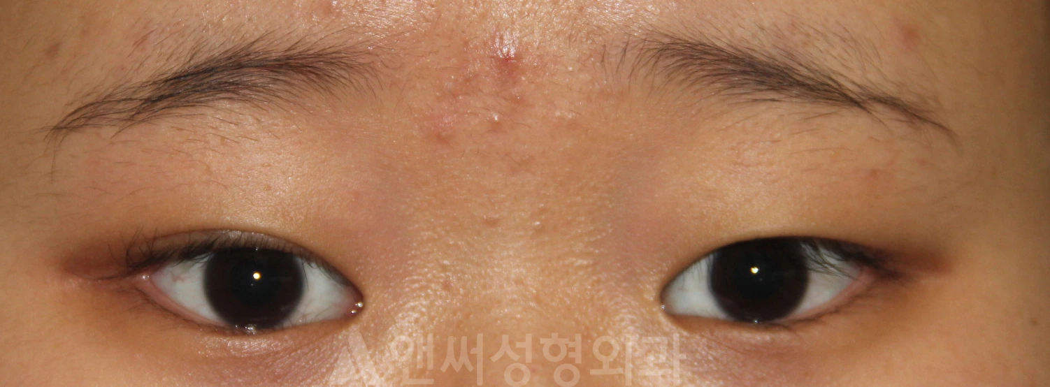 Answer Plastic Surgery case 663: Before