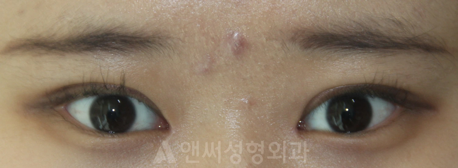Answer Plastic Surgery case 663: After