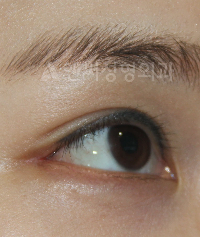 Answer Plastic Surgery case 662: After