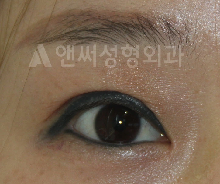 Answer Plastic Surgery case 661: After