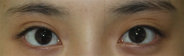 Answer Plastic Surgery case 660: Before