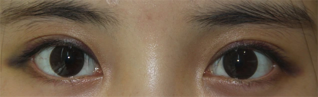 Answer Plastic Surgery case 660: After