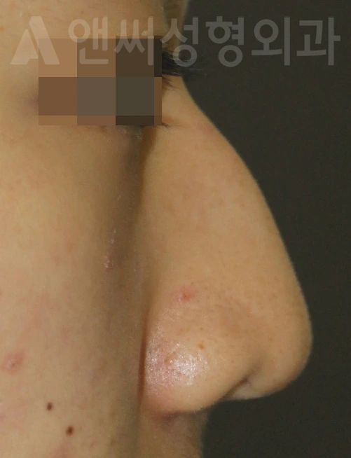 Answer Plastic Surgery case 659: Before