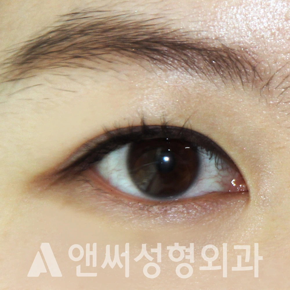 Answer Plastic Surgery case 657: After