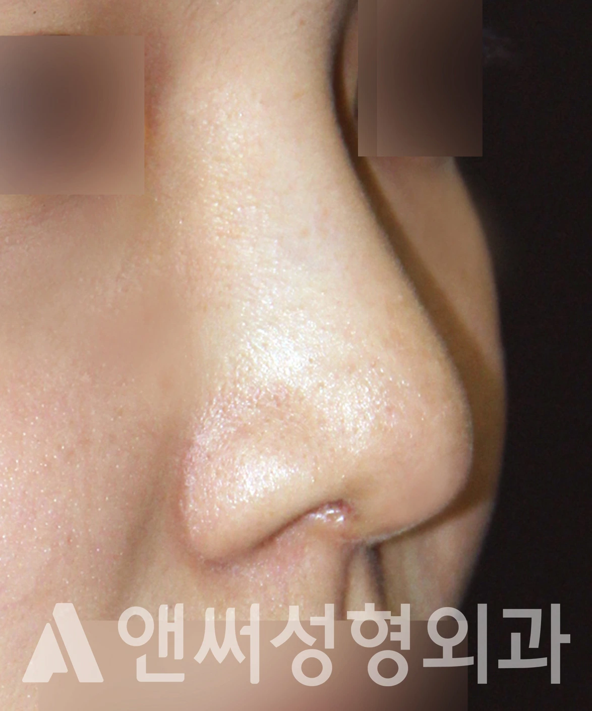 Answer Plastic Surgery case 655: After