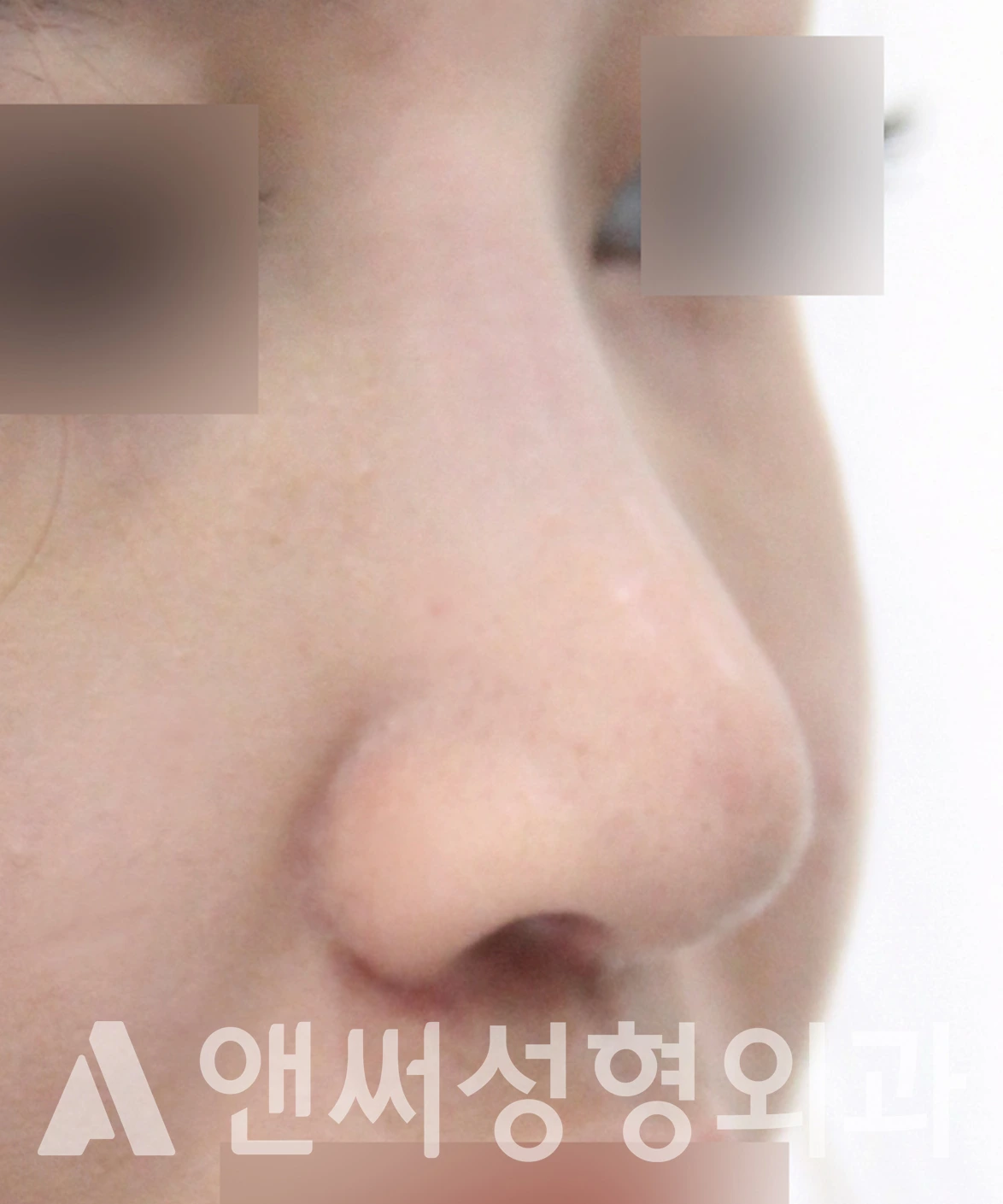 Answer Plastic Surgery case 654: After