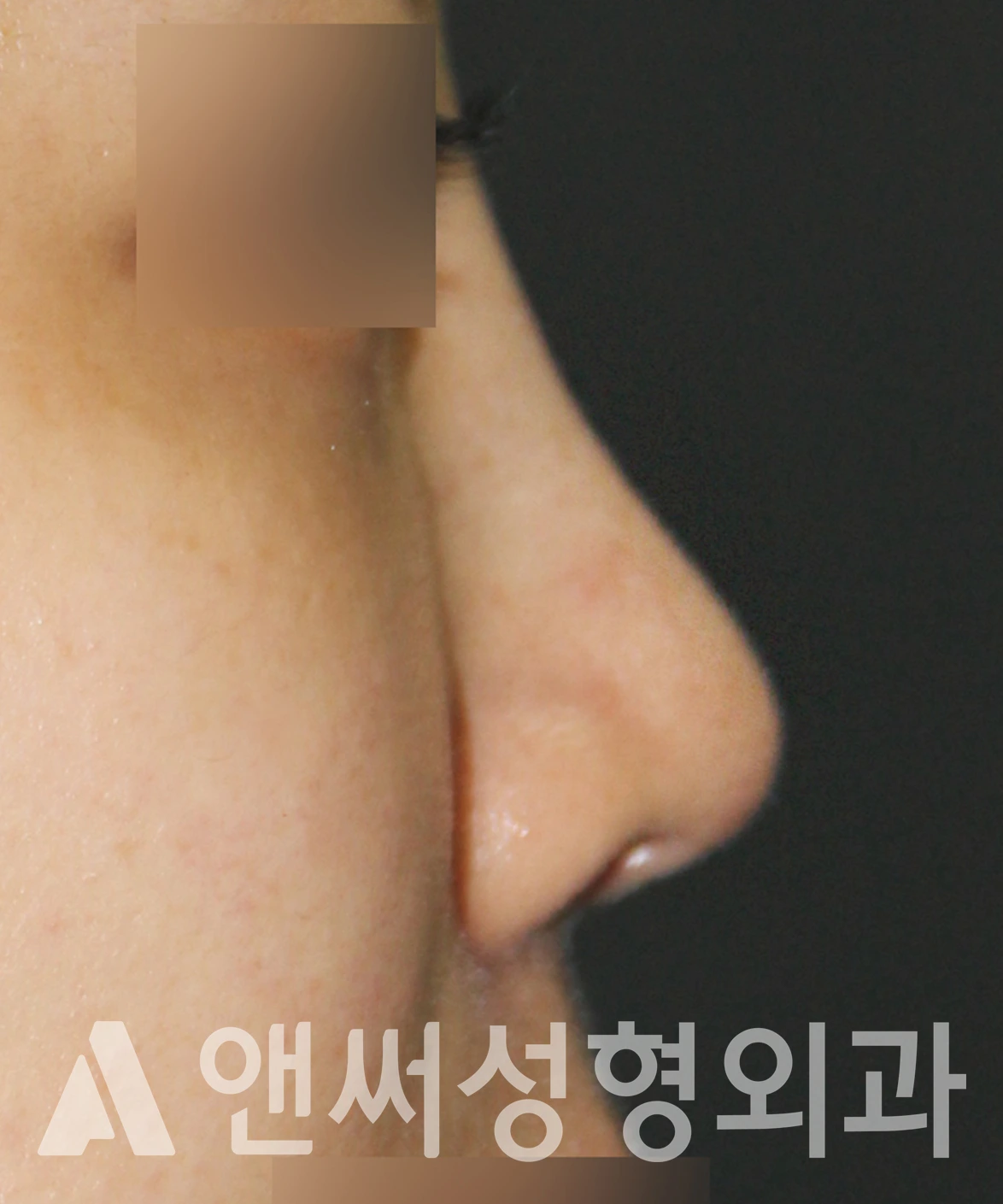 Answer Plastic Surgery case 653: After