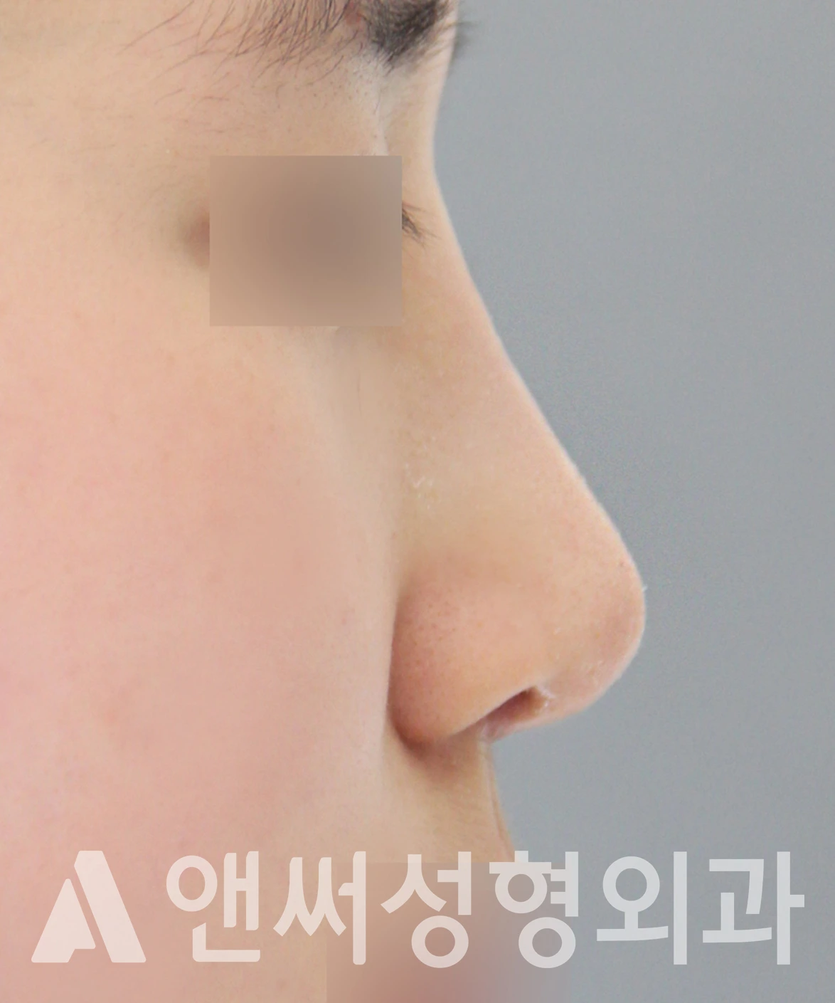 Answer Plastic Surgery case 652: After