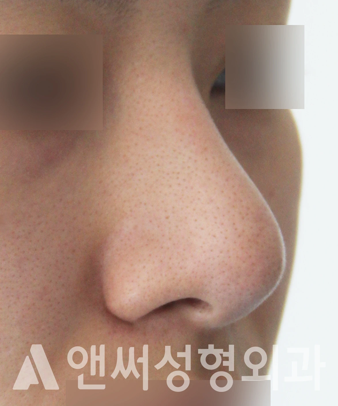Answer Plastic Surgery case 651: Before