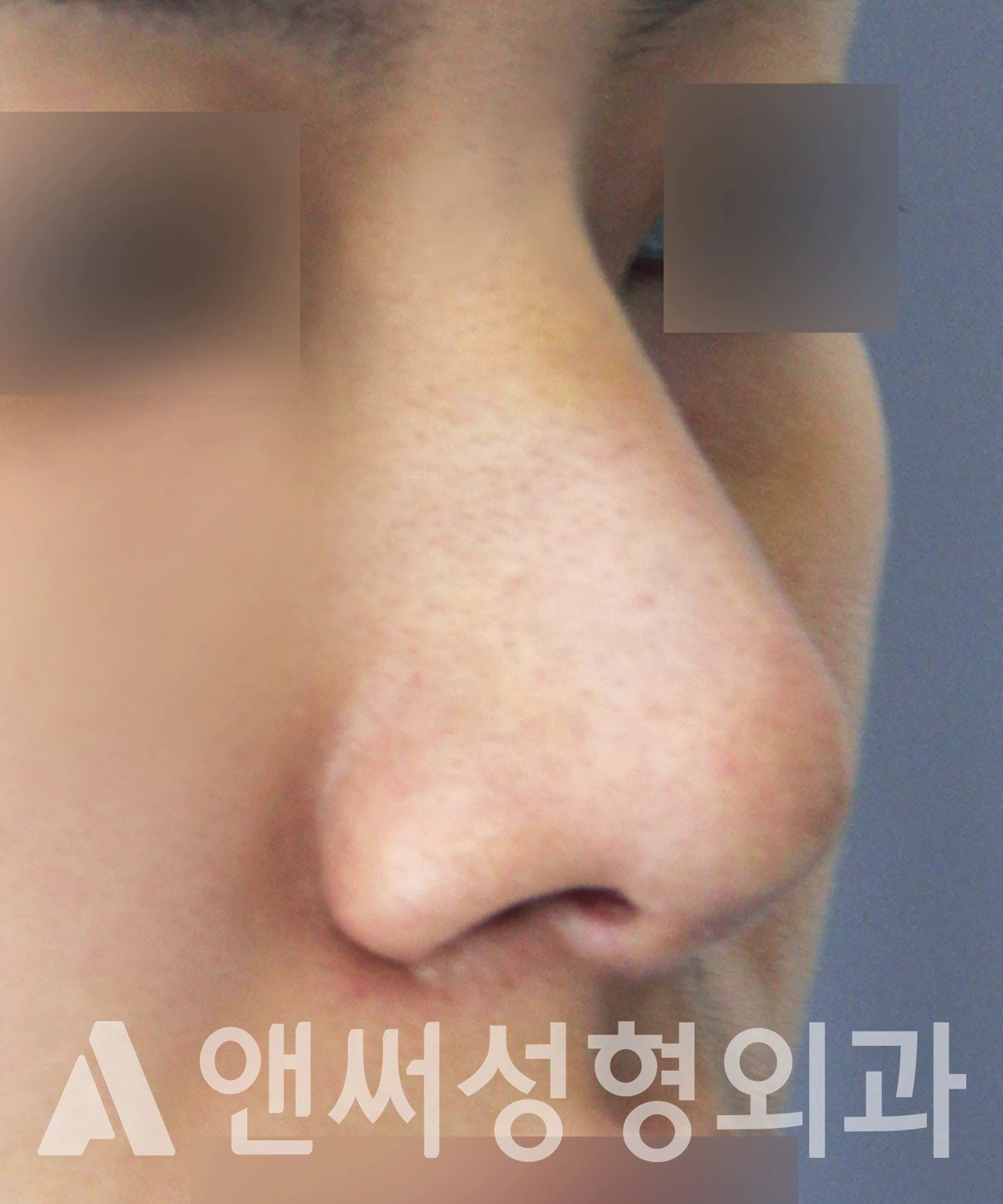 Answer Plastic Surgery case 651: After