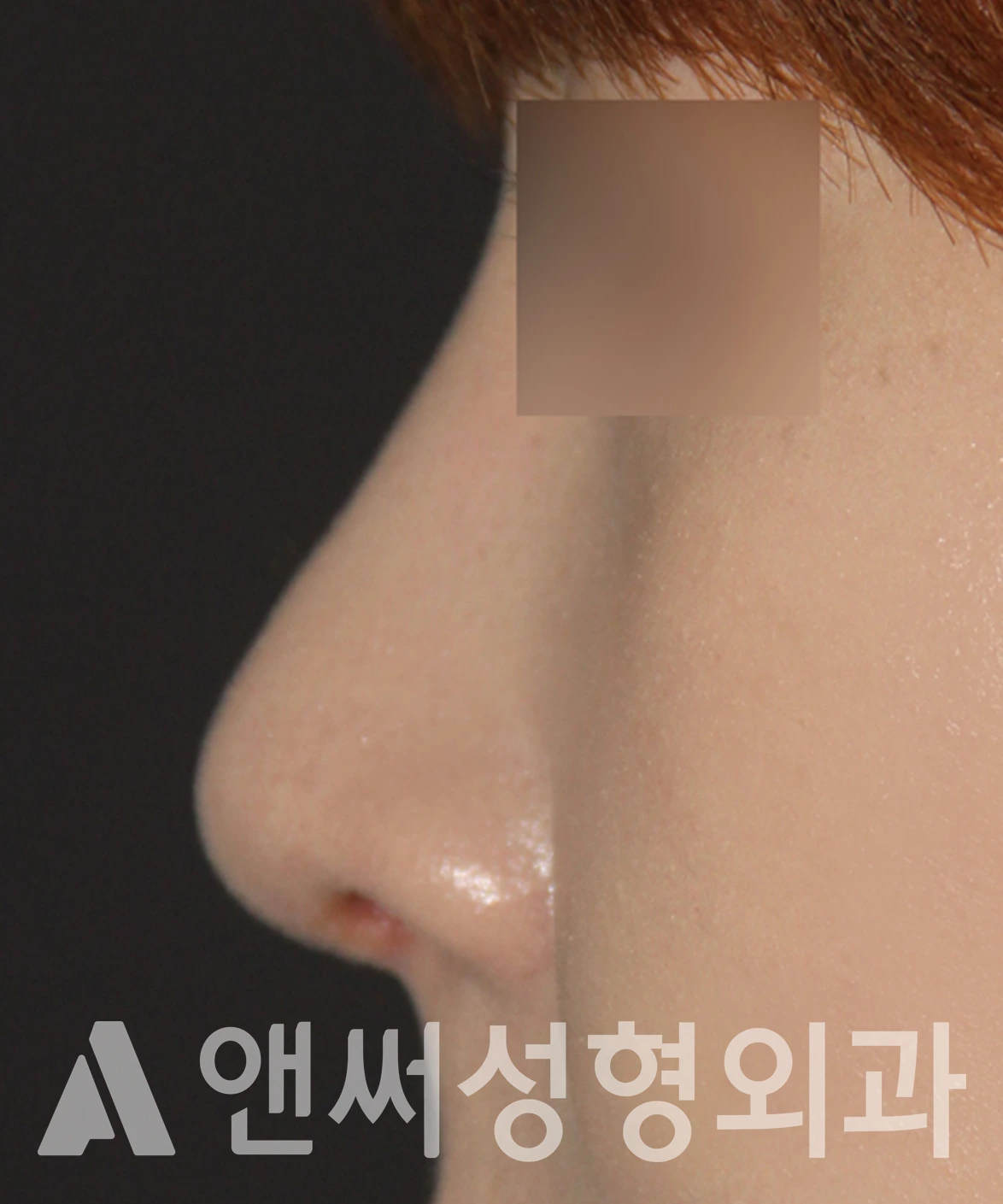 Answer Plastic Surgery case 649: After
