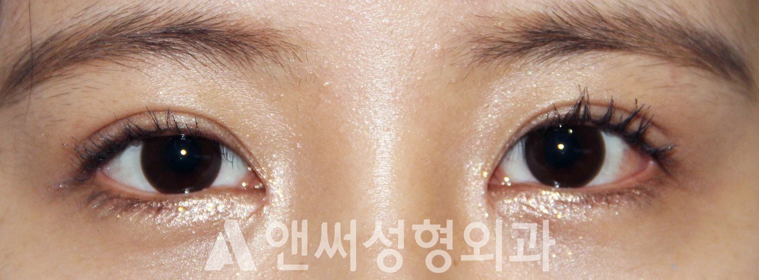 Answer Plastic Surgery case 624: After