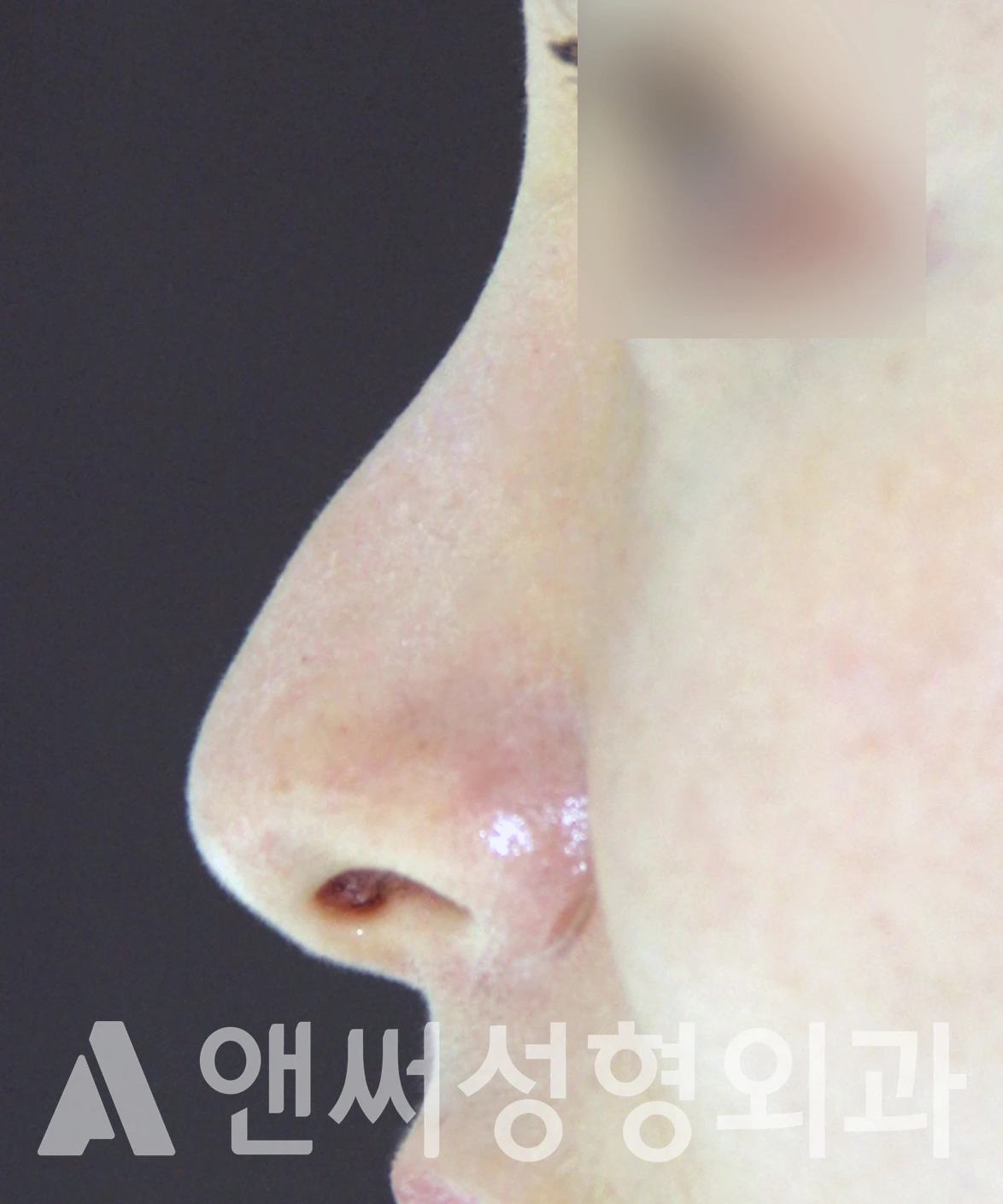 Answer Plastic Surgery case 623: Before