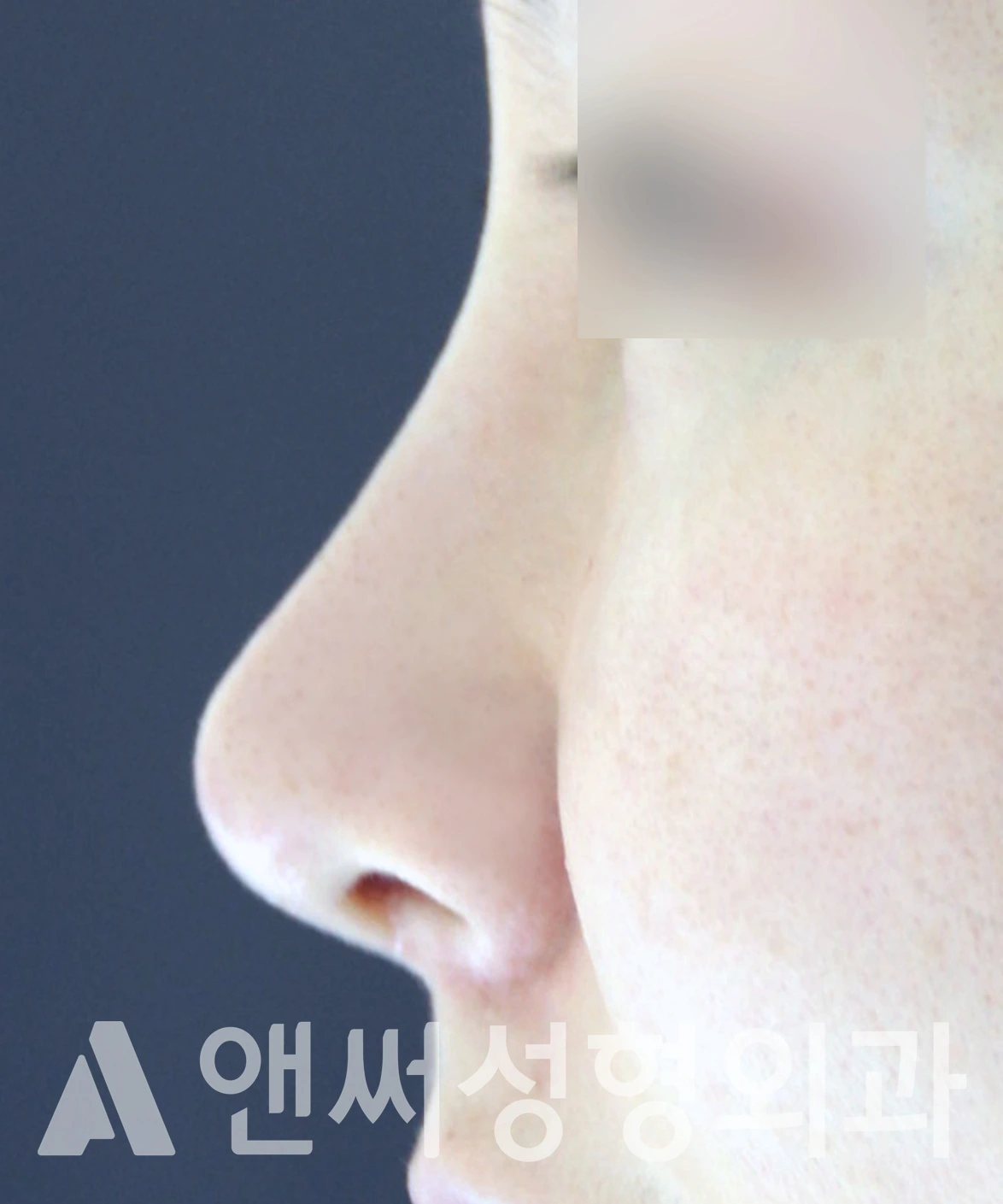 Answer Plastic Surgery case 623: After