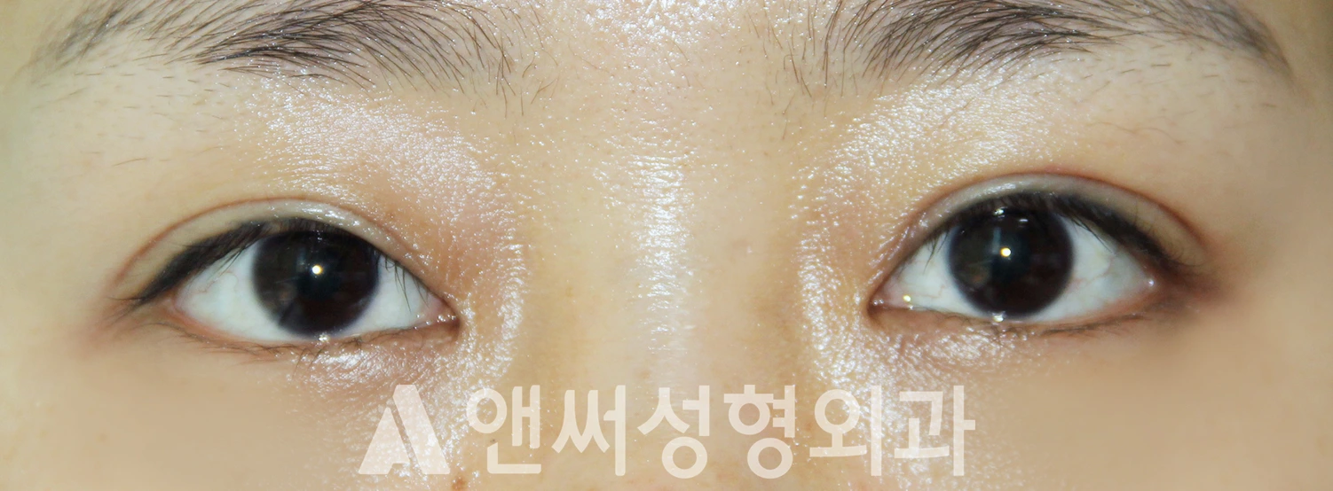 Answer Plastic Surgery case 622: After
