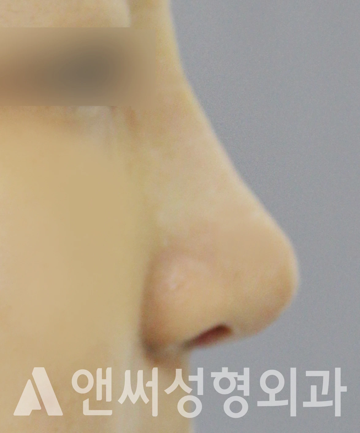 Answer Plastic Surgery case 621: After