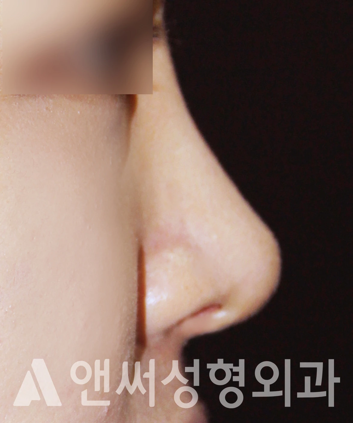 Answer Plastic Surgery case 620: After