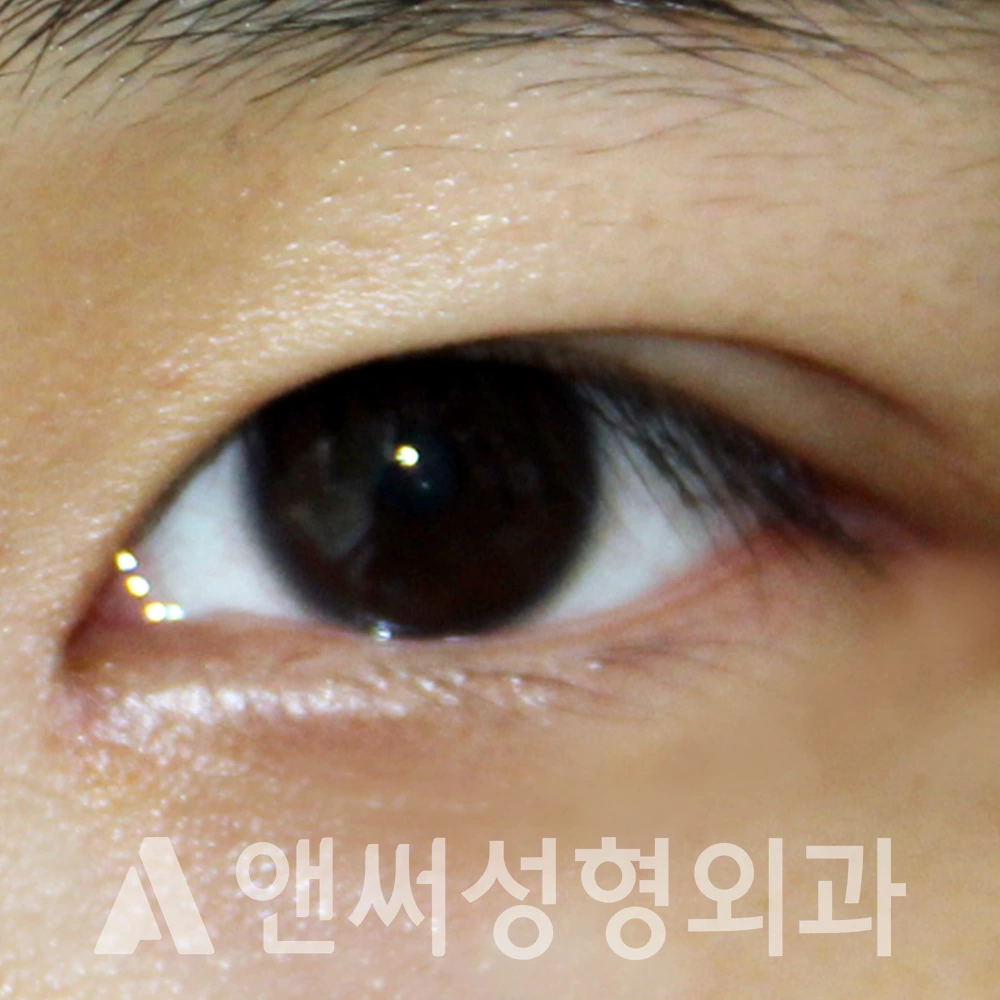 Answer Plastic Surgery case 619: After