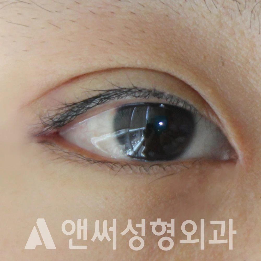 Answer Plastic Surgery case 618: After