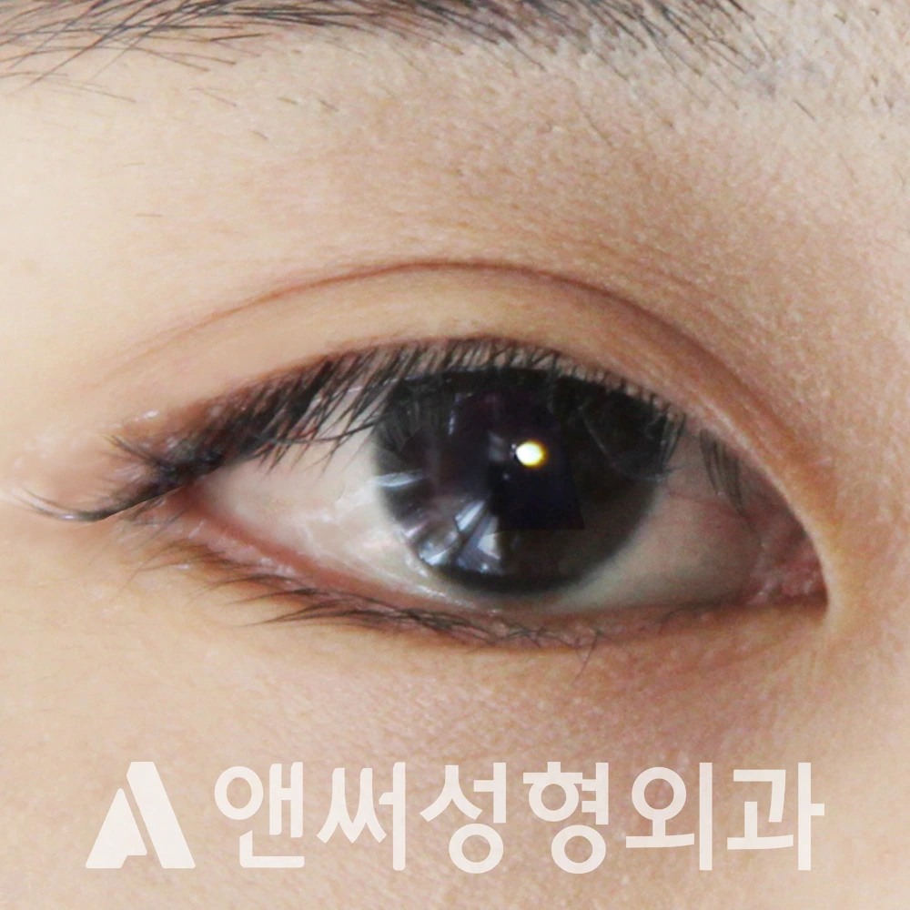 Answer Plastic Surgery case 617: After
