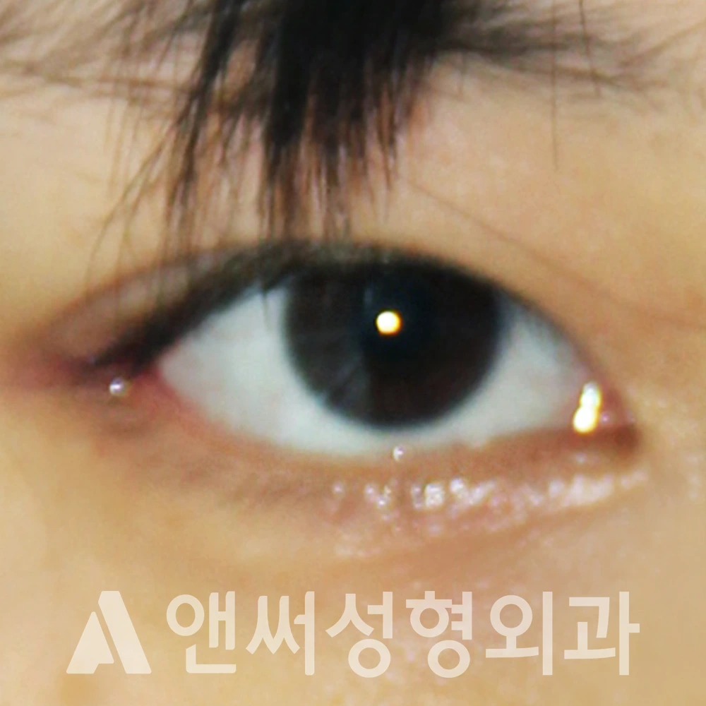 Answer Plastic Surgery case 616: After