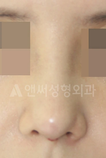 Answer Plastic Surgery case 614: After