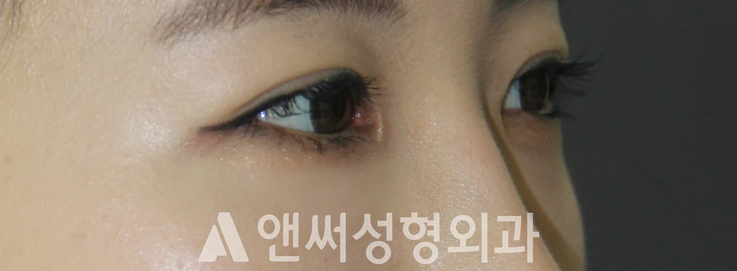 Answer Plastic Surgery case 613: After