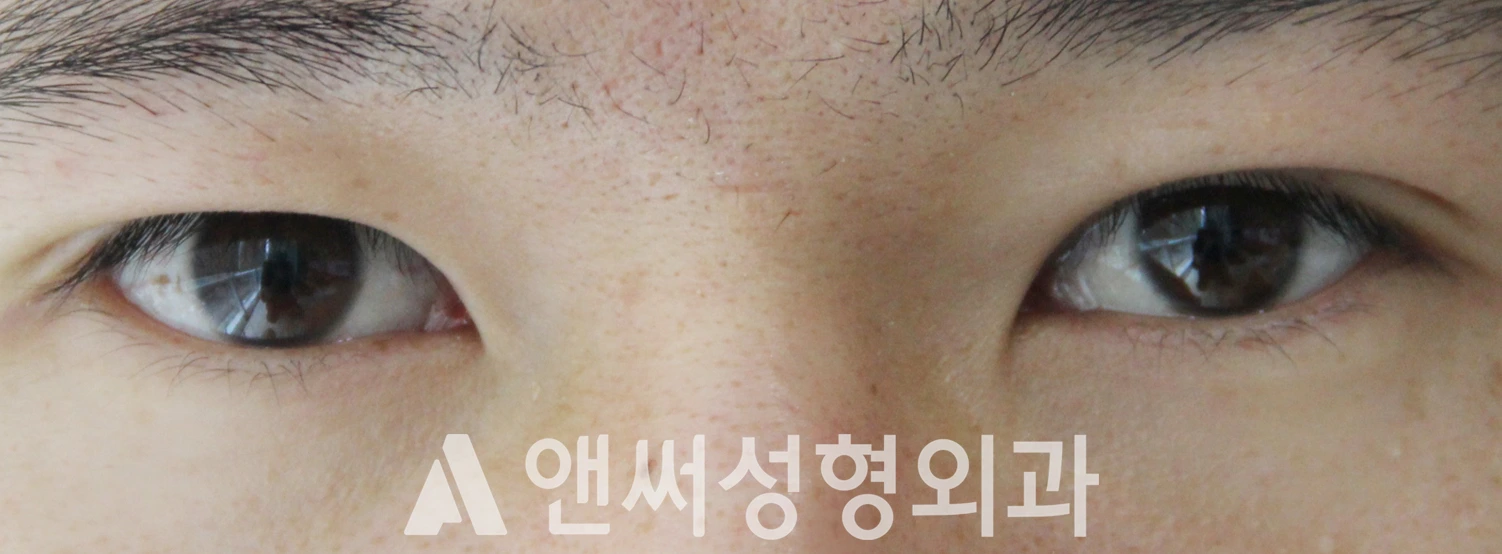 Answer Plastic Surgery case 612: After