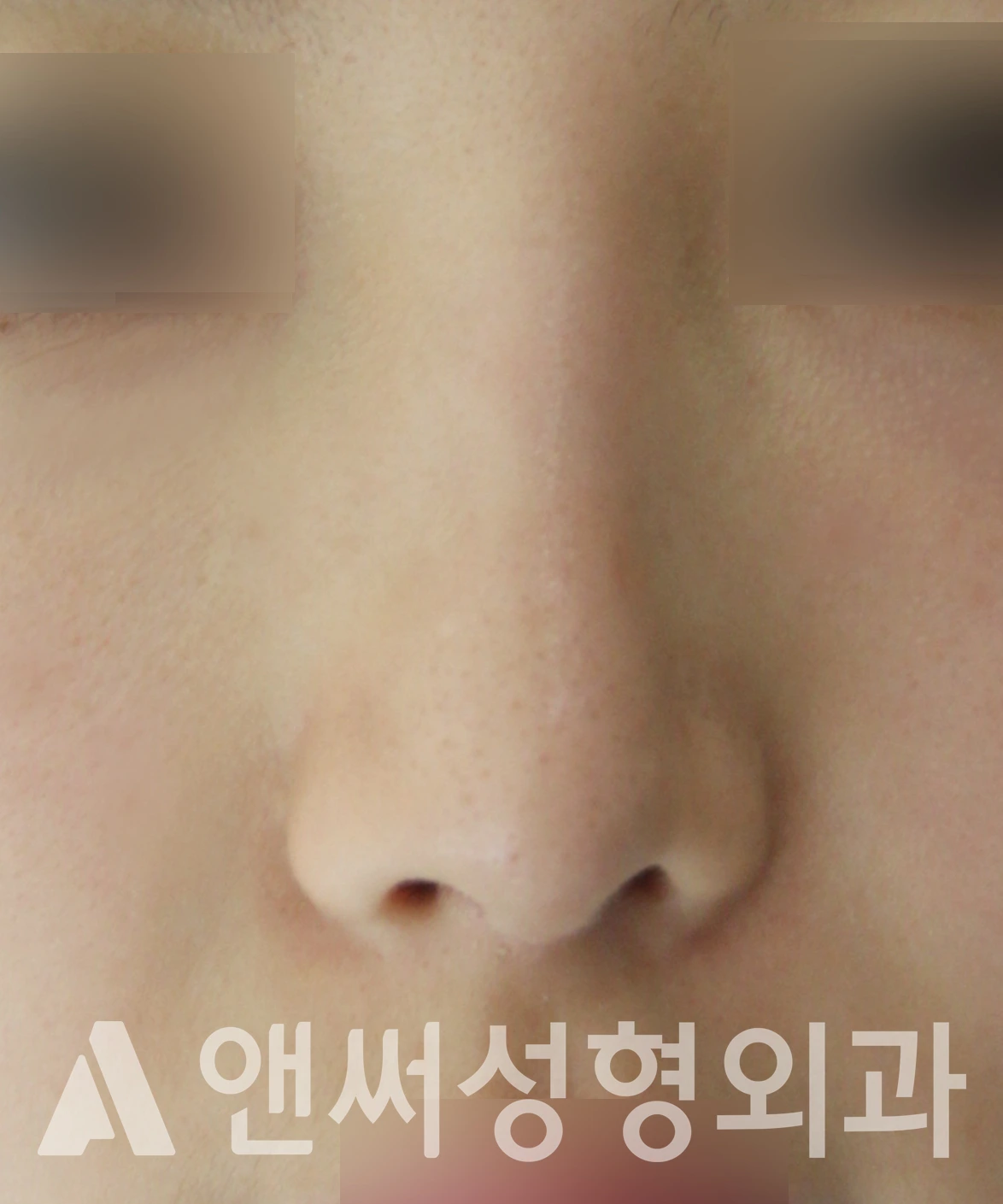 Answer Plastic Surgery case 611: After
