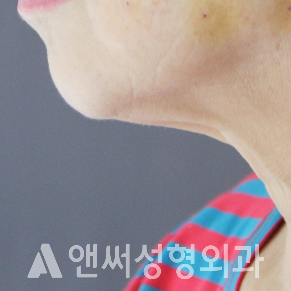 Answer Plastic Surgery case 610: After