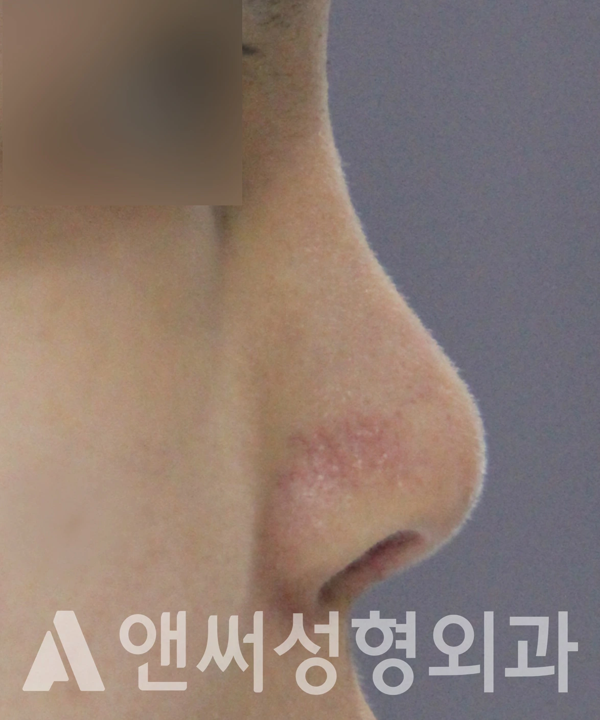 Answer Plastic Surgery case 609: Before
