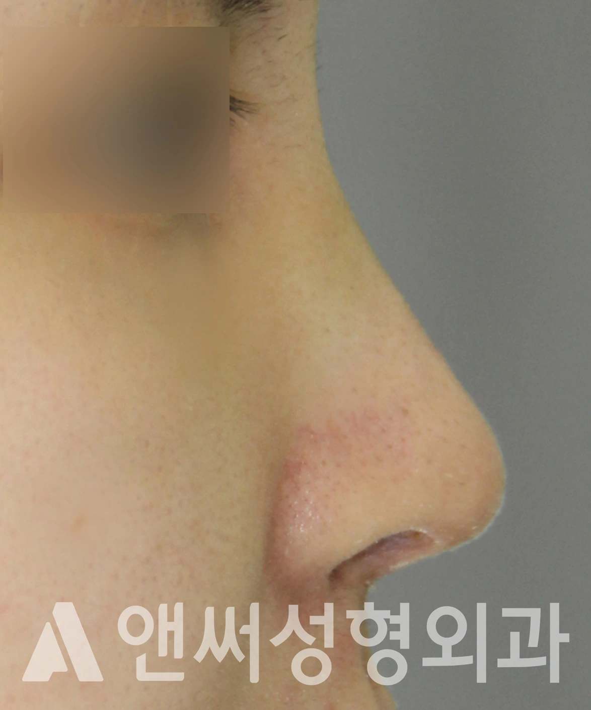 Answer Plastic Surgery case 609: After