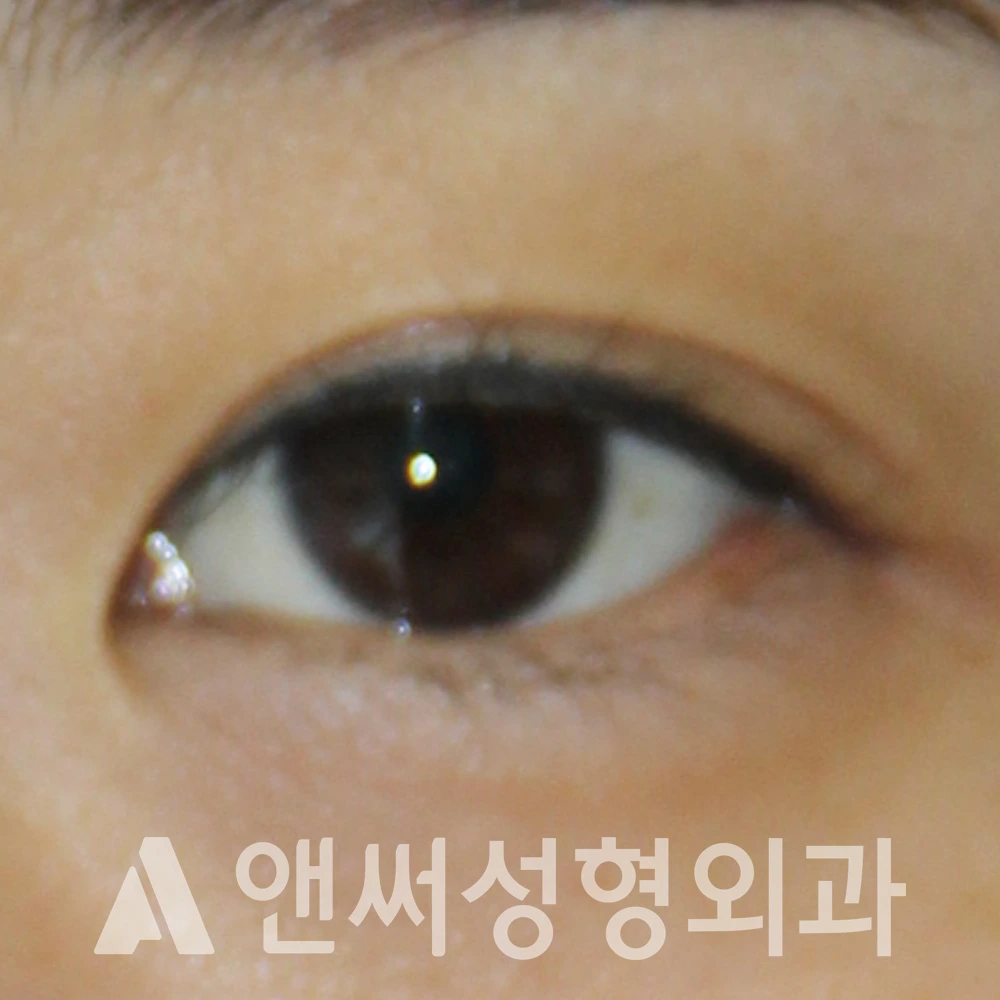 Answer Plastic Surgery case 608: Before