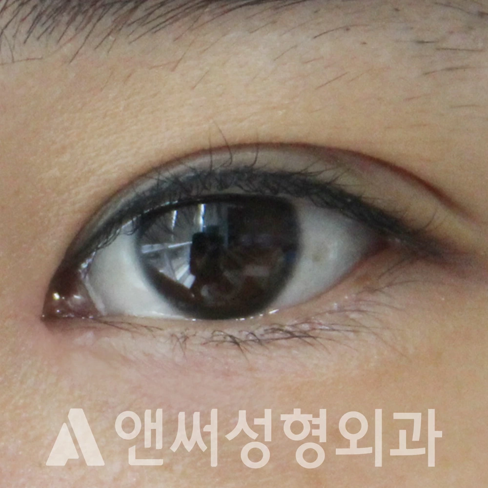 Answer Plastic Surgery case 608: After