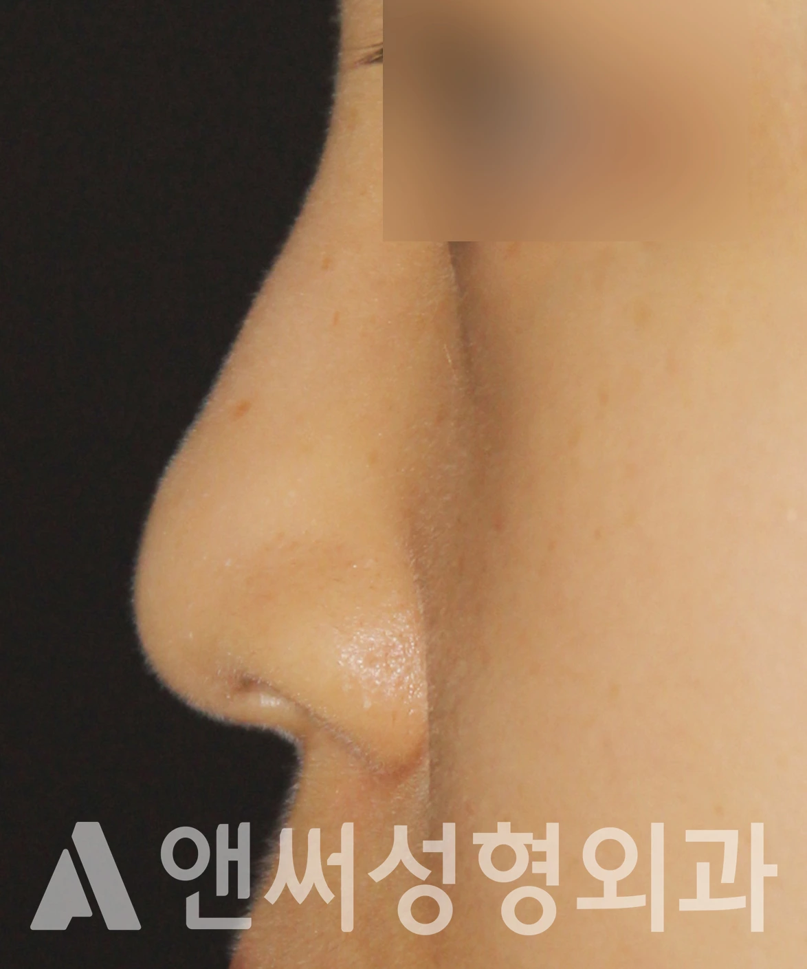 Answer Plastic Surgery case 607: Before